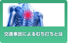 交通事故によるむち打ちとは